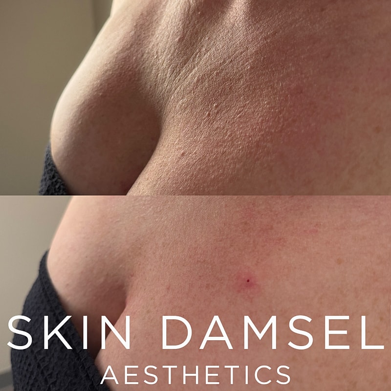 Declotage Gallery Before & After