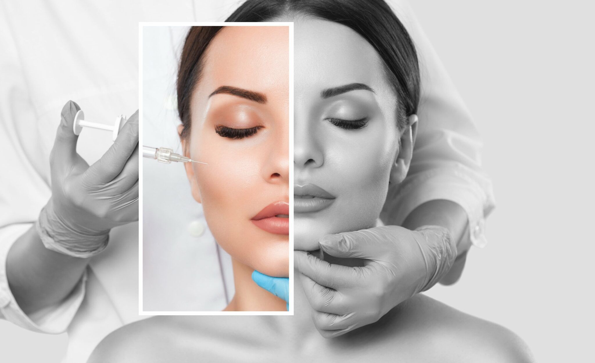Let’s Talk Dermal Fillers!